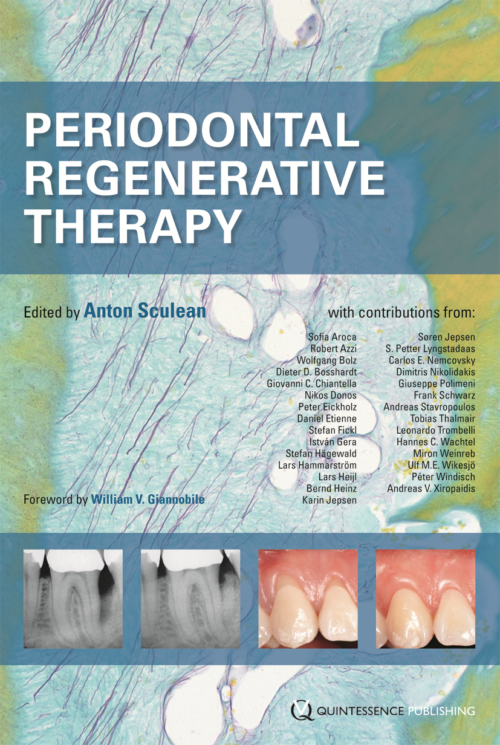 Periodontal Regenerative Therapy