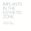 Implants in the Esthetic Zone