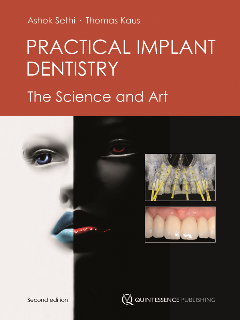 Practical Implant Dentistry - Dentalbookshop