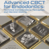 Advanced CBCT for Endodontics: Technical Considerations, Perception, and Decision-Making