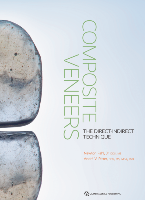 Composite Veneers