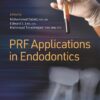 PRF Applications in Endodontics