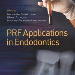 PRF Applications in Endodontics