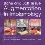 Bone and Soft Tissue Augmentation in Implantology
