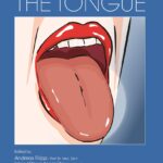 The Tongue