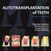 Autotransplantation of Teeth