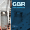GBR Strategies