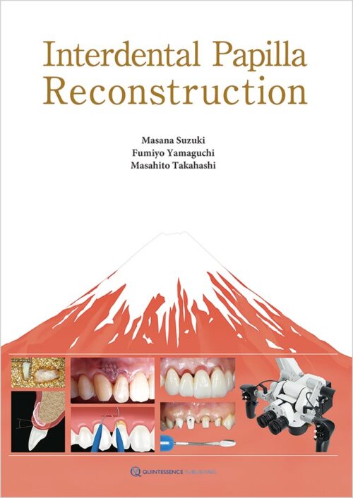 Interdental Papilla Reconstruction