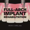 Full-arch Implant Rehabilitation