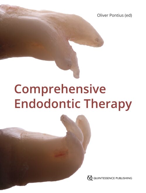Comprehensive Endodontic Therapy
