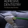 Adhesive Dentistry - The Step by Step Workflow