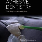 Adhesive Dentistry - The Step by Step Workflow