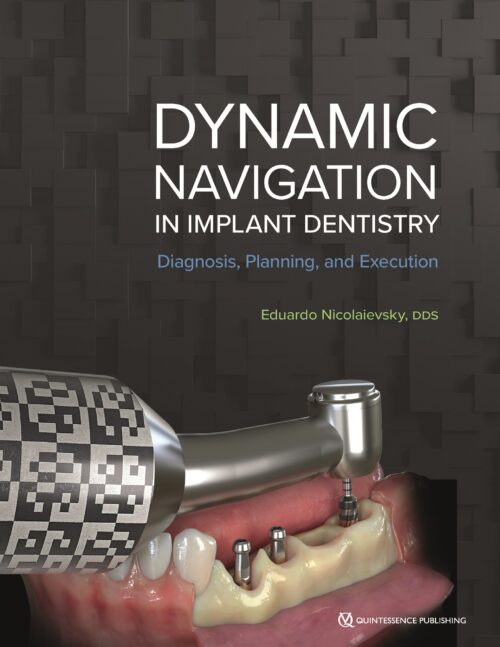Dynamic Navigation in Implant Dentistry