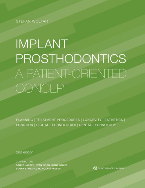 Implant Prosthodontics